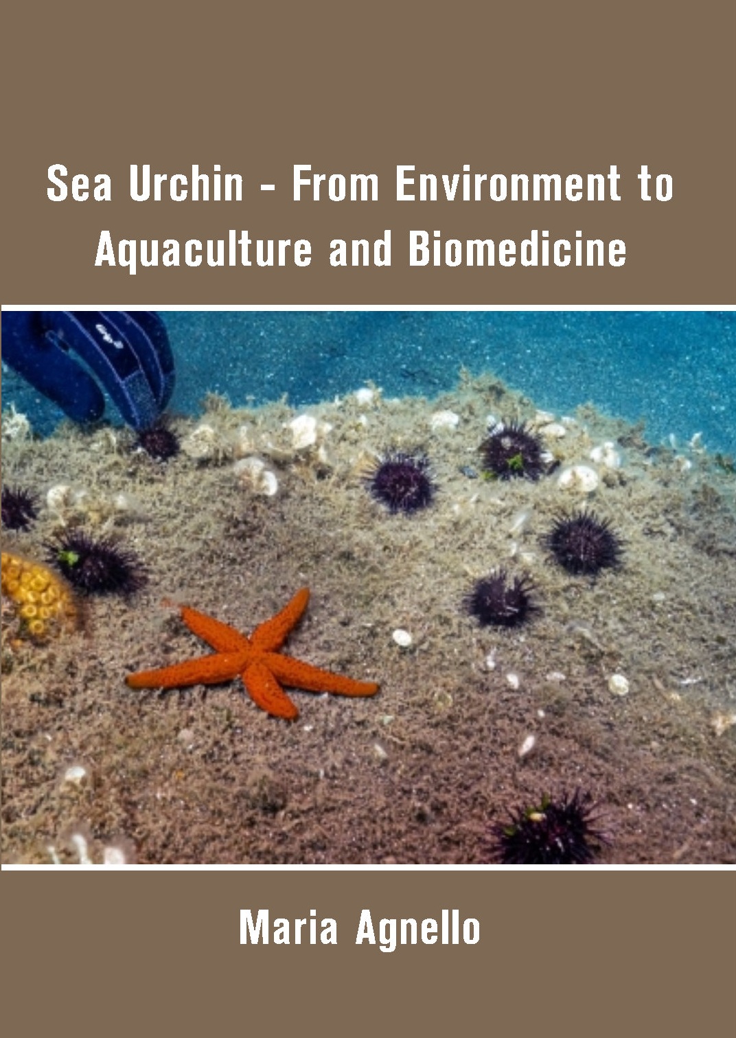 Sea Urchin - From Environment to Aquaculture and Biomedicine